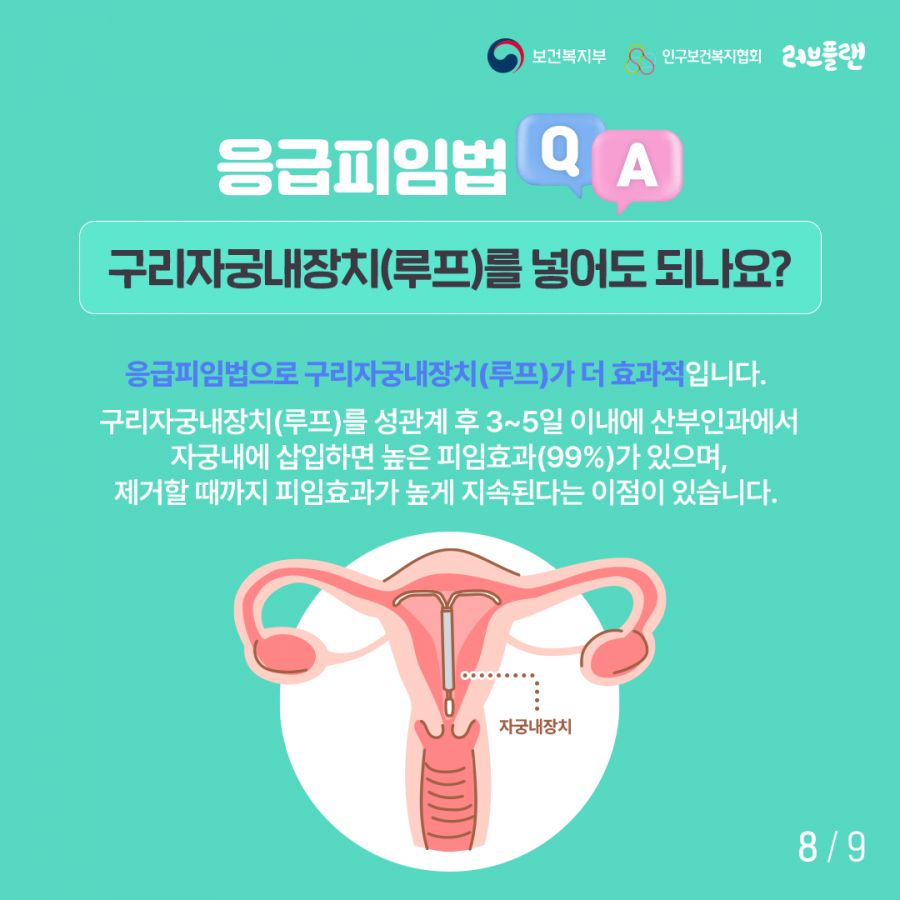 보건복지부로고,인구보건복지협회로고,러브플랜로고 응급피임법 Q&A 구리자궁내장치(루프)를 넣어도 되나요? 응급피임법으로 구리자궁내장치(루프)가 더 효과적입니다. 구리자궁내장치(루프)를 성관계 후 3~5일이내에 산부인과에서 자궁내에 삽입하면 높은 피임효과(99%)가 있으며, 제거할 때까지 피임효과가 높게 지속된다는 이점이 있습니다.