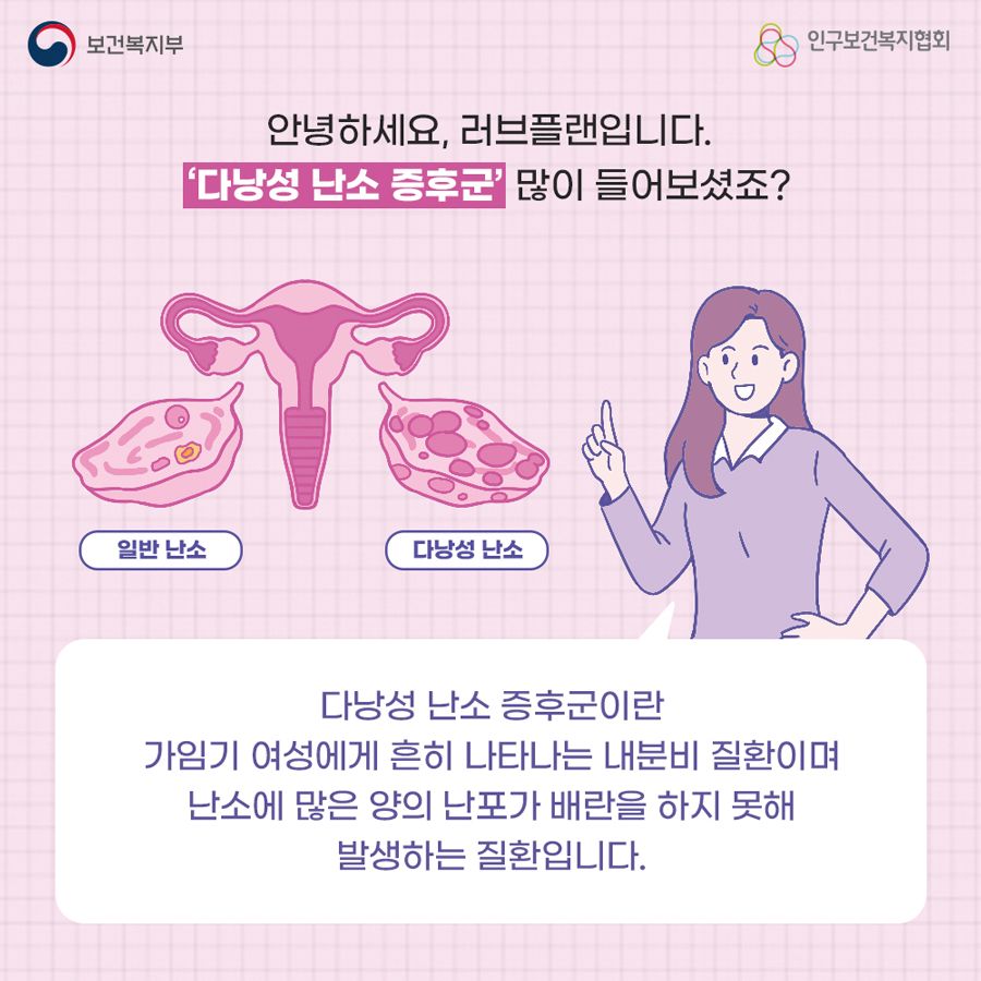 안녕하세요, 러브플랜입니다. '다낭성 난소 증후군' 많이 들어보셨죠? 다낭성 난소 증후군이란 가임기 여성에게 흔히 나타나는 내분비 질환이며 난소에 많은 양의 난포가 배란을 하지 못해 발생하는 질환입니다.