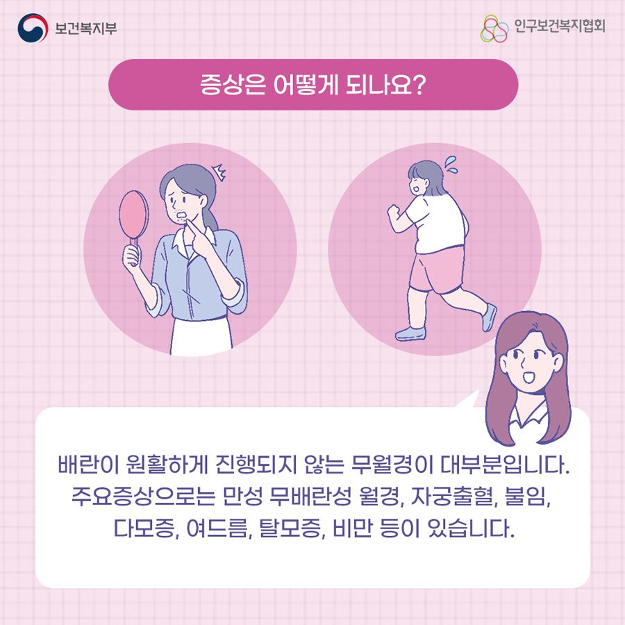 증상은 어떻게 되나요? 배란이 원활하게 진행되지 않는 무월경이 대부분입니다. 주요증상으로는 만성 무배란성 월경, 자궁출혈, 불임, 다모증, 여드름, 탈모증, 비만 등이 있습니다.