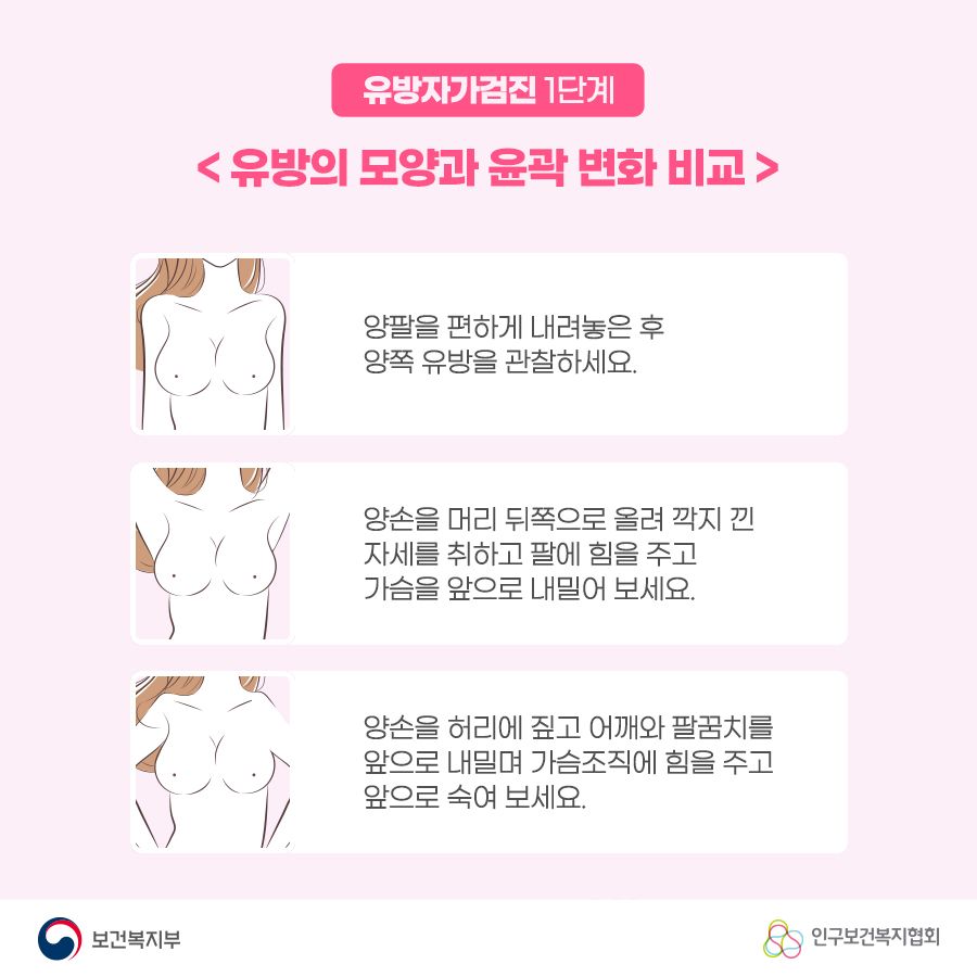 유방자가검진 1단계 <유방의 모양과 윤곽 변화 비교> 1. 양팔을 편하게 내려놓은 후 양쪽 유방을 관찰하세요. 2. 양손을 머리 뒤쪽으로 올려 깍지 낀 자세를 취하고 팔에 힘을 주고 가슴을 앞으로 내밀어 보세요. 3. 양손을 허리에 짚고 어깨와 팔꿈치를 앞으로 내밀며 가슴조직에 힘을 주고 앞으로 숙여보세요.