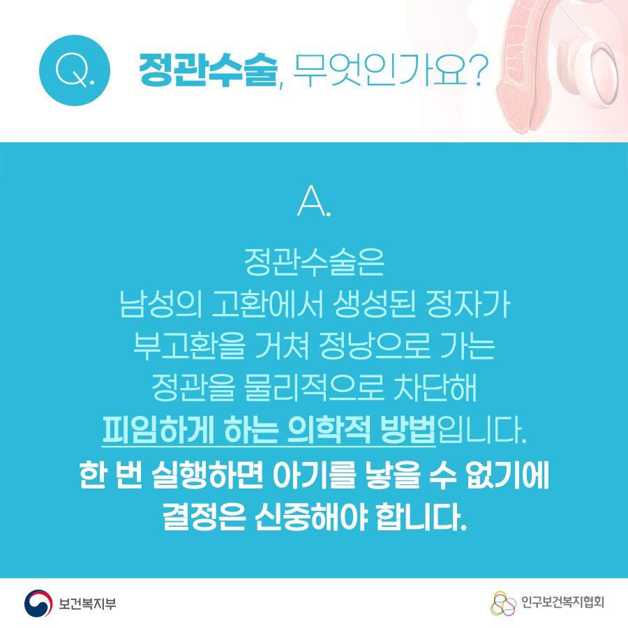 Q. 정관수술, 무엇인가요? A. 정관수술은 남성의 고환에서 생성된 정자가 부고환을 거쳐 정낭으로 가는 정관을 물리적으로 차단해 피임하게 하는 의학적 방법입니다. 한 번 실행하면 아기를 낳을 수 없기에 결정은 신중해야합니다. 보건복지부로고,인구보건복지협회로고